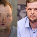 Njegovo lice bilo je uništeno, a danas je živi dokaz Boga na djelu