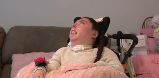 Žena rođena bez mozga puni 20 godina, obitelj kaže da je čudo