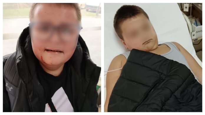 Dječak (10) je žrtva zlostavljanja vršnjaka