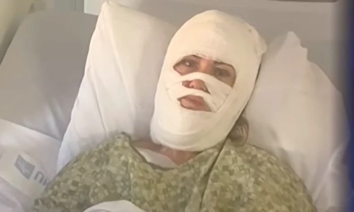 Žena je šetala parkom, a onda ju je prolaznik polio tekućinom: Odmah je počela gorjeti