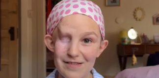 Zbog raka je ostala bez oka i kose, no optimistično poručuje: "Gubitak me naučio da volim svaku verziju sebe"