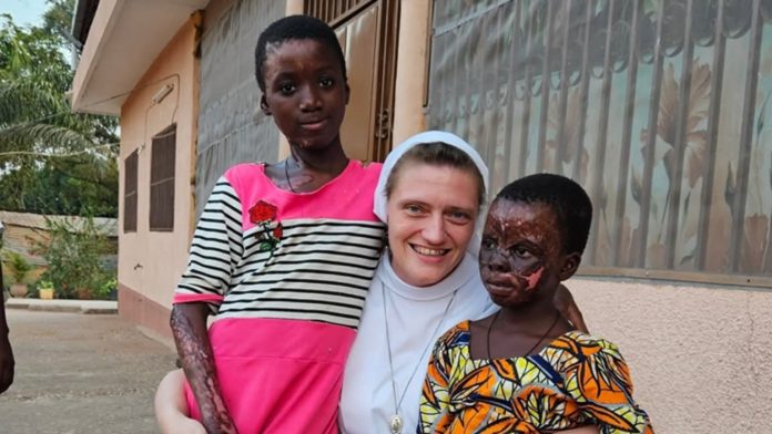 Ove djevojčice iz Afrike su spašene iz vatre i čeka ih operacija u Hrvatskoj