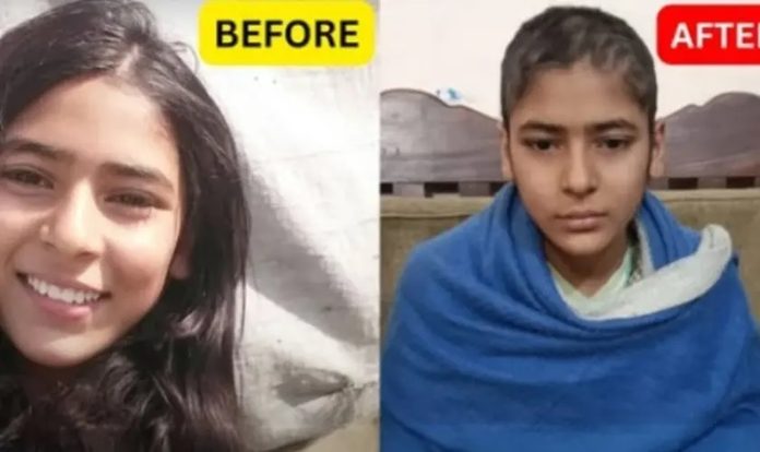 Muslimani u Pakistanu mučili kršćansku tinejdžericu i obrijali joj kosu