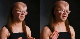 Mlada žena sa sindromom koji uzrokuje preranu smrt svjedoči