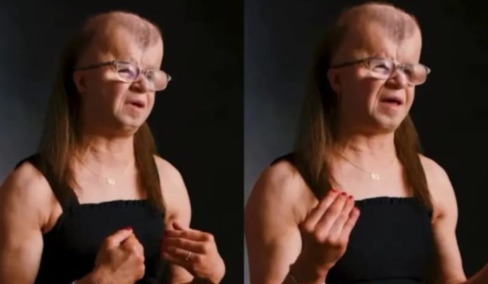 Mlada žena sa sindromom koji uzrokuje preranu smrt svjedoči