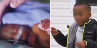 Beba bez otkucaja srca preživjela hitan porod i iznenadila sve