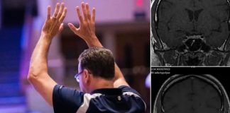 Muškarac kojem je dijagnosticiran tumor na mozgu čudesno je ozdravio nakon što su za njega molili