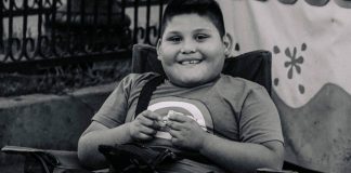 Dječak (7) umro od debljine: Imao je 115 kilograma i stalno jeo ovo