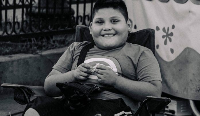 Dječak (7) umro od debljine: Imao je 115 kilograma i stalno jeo ovo