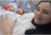 Liječnici nisu vjerovali da će preživjeti: Pogledajte kako danas izgledaju poznate hrvatske sijamske blizanke