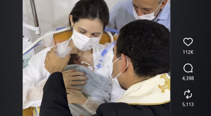 Video koji je mnoge dirnuo: Krštena prijevremeno rođena djevojčica teška samo 570 grama
