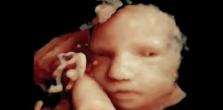 Majka je na ultrazvuku vidjela bebu s otvorenim očima, a tek nakon poroda je otkrila pravu istinu